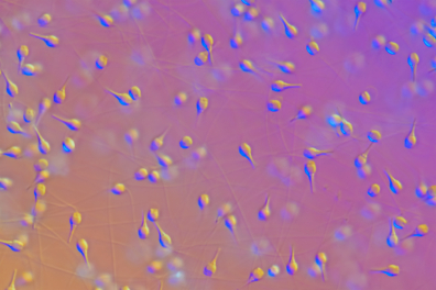 Spermatozoides de Moule (Mytilus edulis) CIT x250